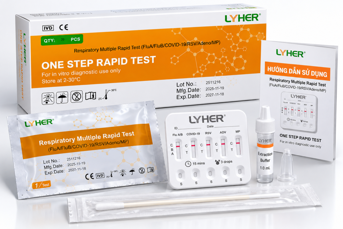 Khi Nào Nên Test MP